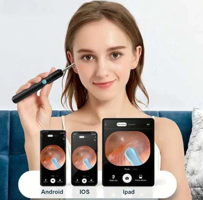 KIT LIMPIADOR DE OÍDOS HD – ADIÓS COPITOS, LIMPIEZA PROFUNDA Y SEGURA